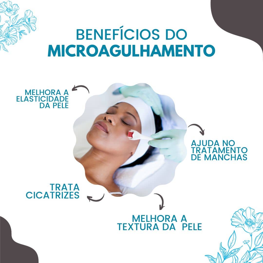 microagulhamento melhora a saúde da pele