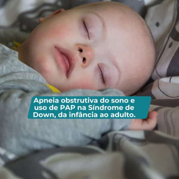 Sono e Cuidados Respiratórios:  Apneia obstrutiva do sono e uso de PAP na Síndrome de Down, da infância ao adulto.